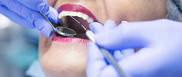 Best Emergency Root Canal Treatment in Simpsonville, SC